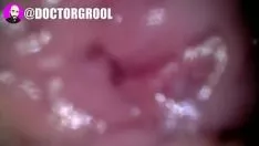 Abspielen Reisen Sie ins Innere einer nassen Kätzchenkatze: Endoteleskop-Videoaufzeichnung zum Arzt, die eine dicke Vagina besucht