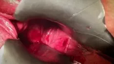 Play Cervix uteri toy